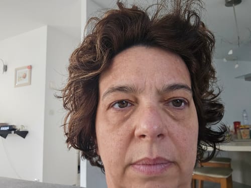 Customer photo review of Patchs Hydratants | Éliminez cernes & rides