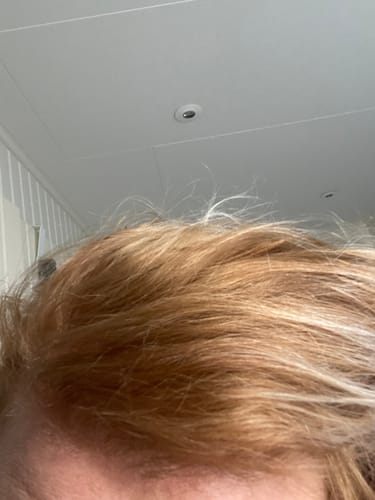 Customer photo review of Sunkissed Starter Kit