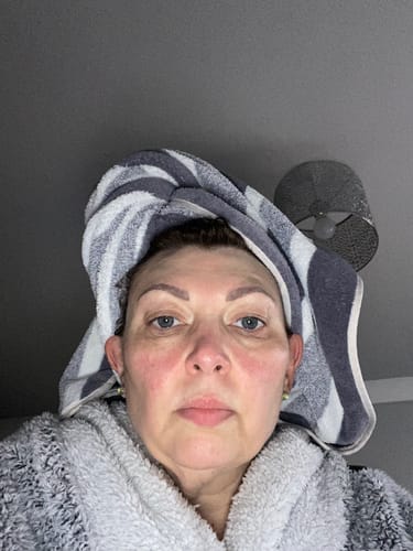 Customer photo review of Rosalique 3 in 1 Anti-Redness Miracle Formula SPF50