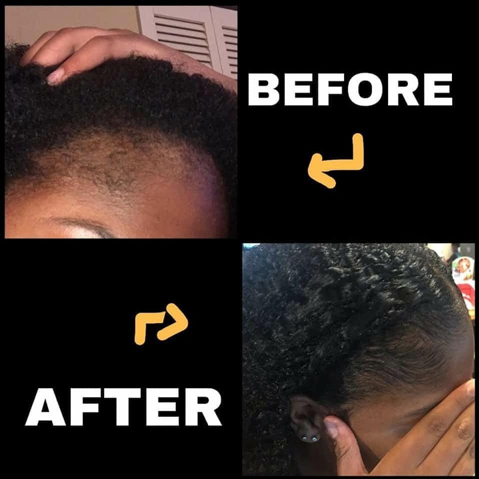 Customer photo review of Hair Follicle Mist