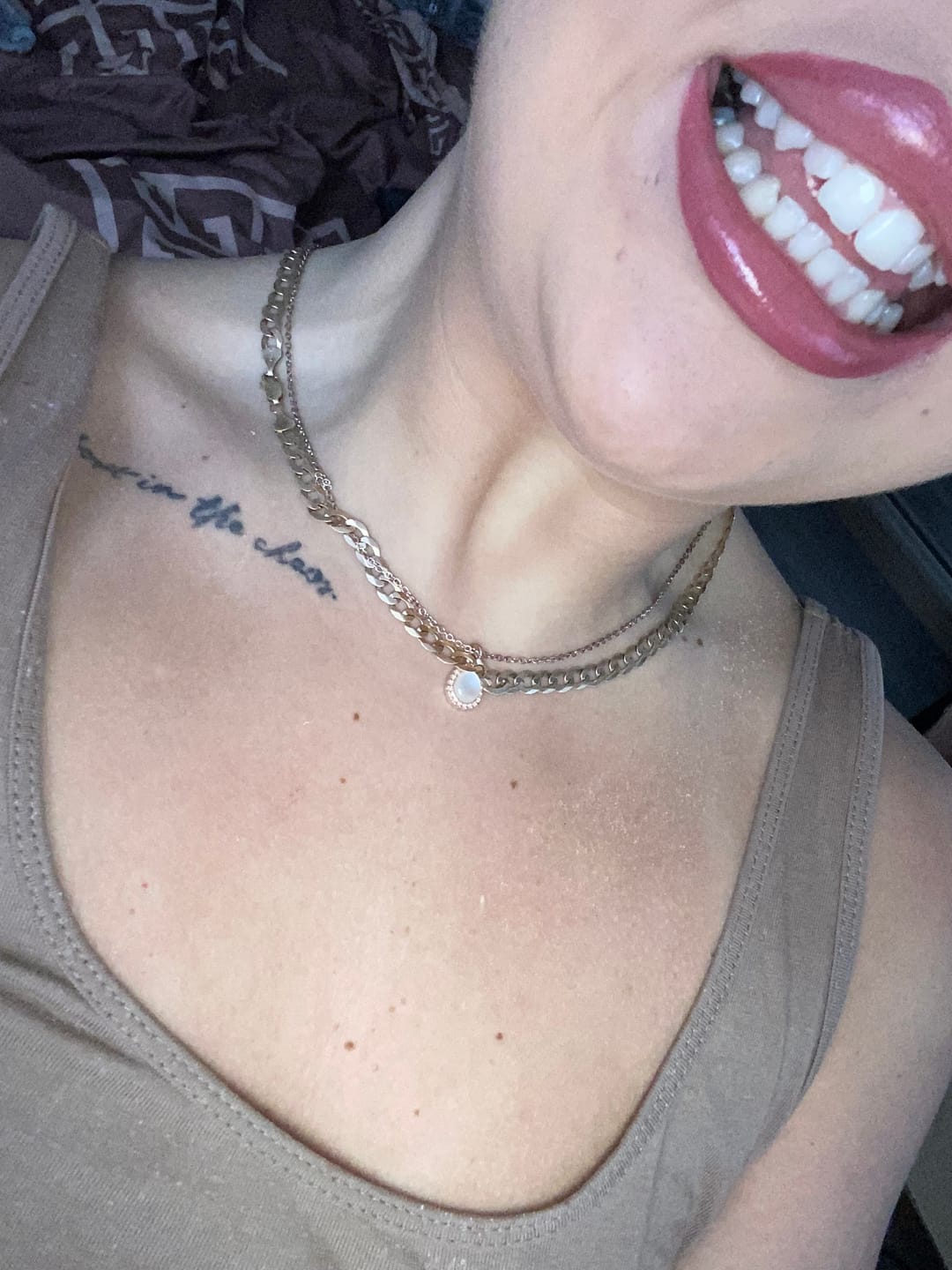 Customer photo review of Teeth Whitening Strips