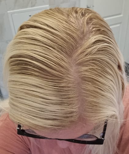 Customer photo review of Sunkissed Starter Kit