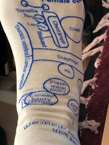 Customer photo review of Reflexology Socks With Massage Tool for Women and Men Foot Massage Socks