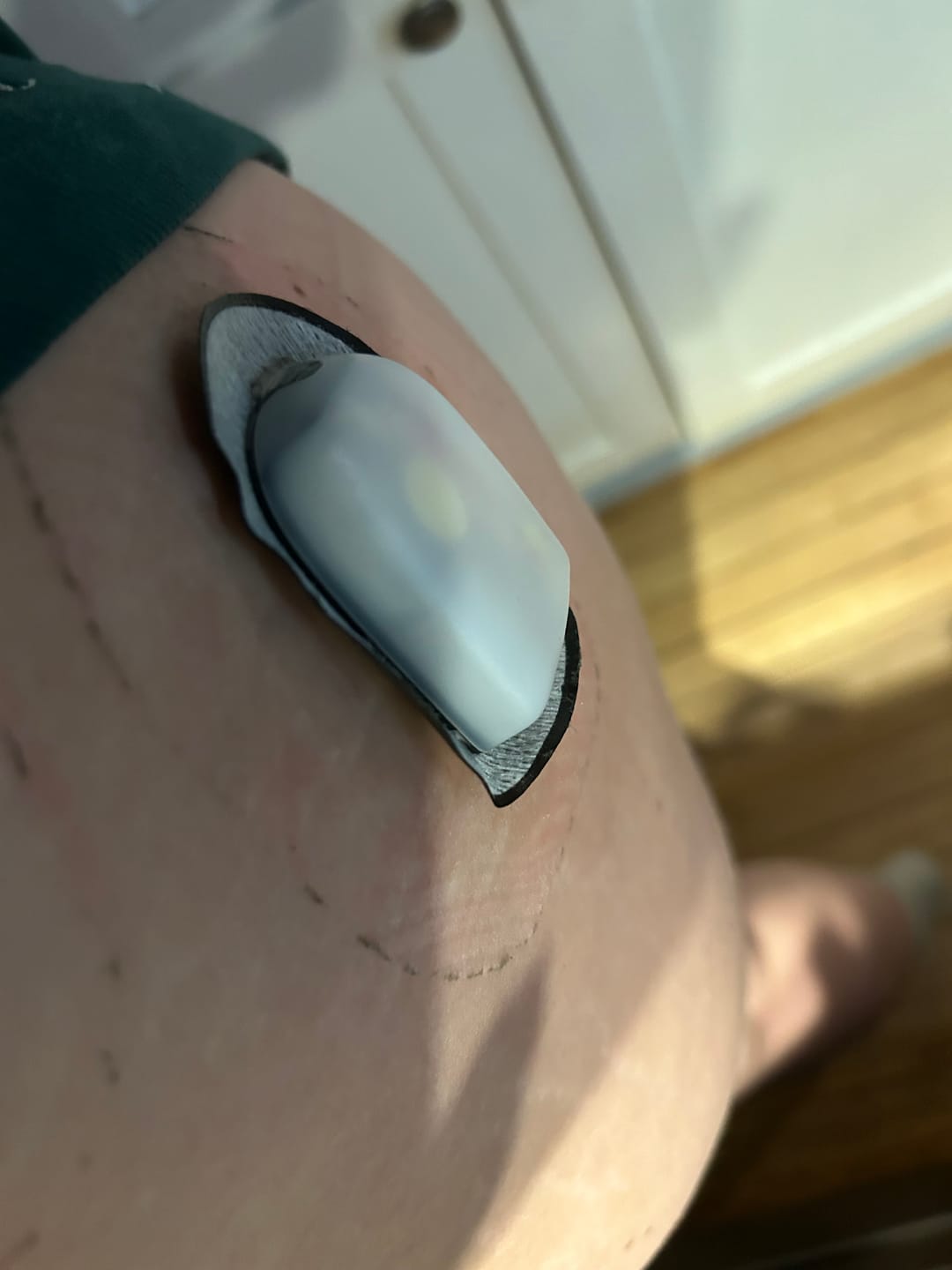Customer photo review of Skin Shield Reusable Non-Adhesive Barrier - 5 Pack