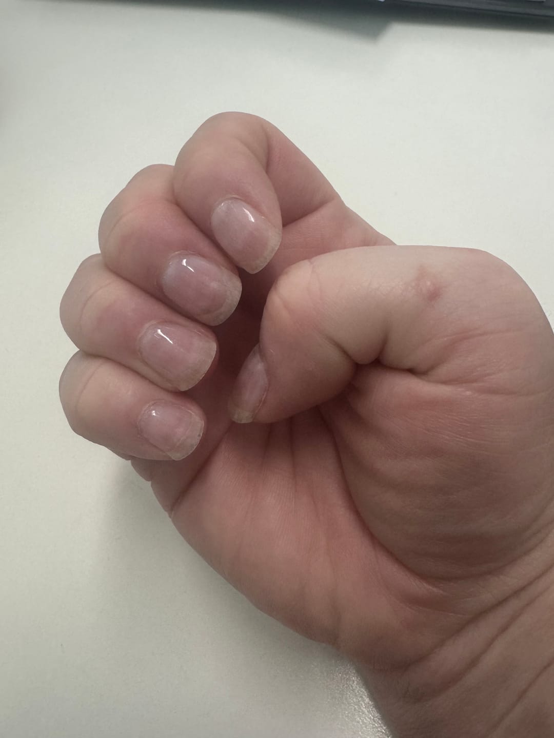 Customer photo review of Crystal Clear DIY Semicured Gel Nail Sticker Kit (STOP NAIL BITING & GROW BRITTLE NAILS)