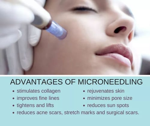 Customer photo review of Microneedle / Nanoneedle Cartridge
