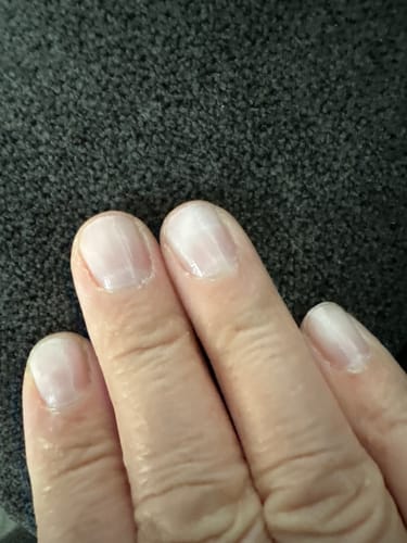 Customer photo review of Rocket Nail Fuel Nail Repair - Clear