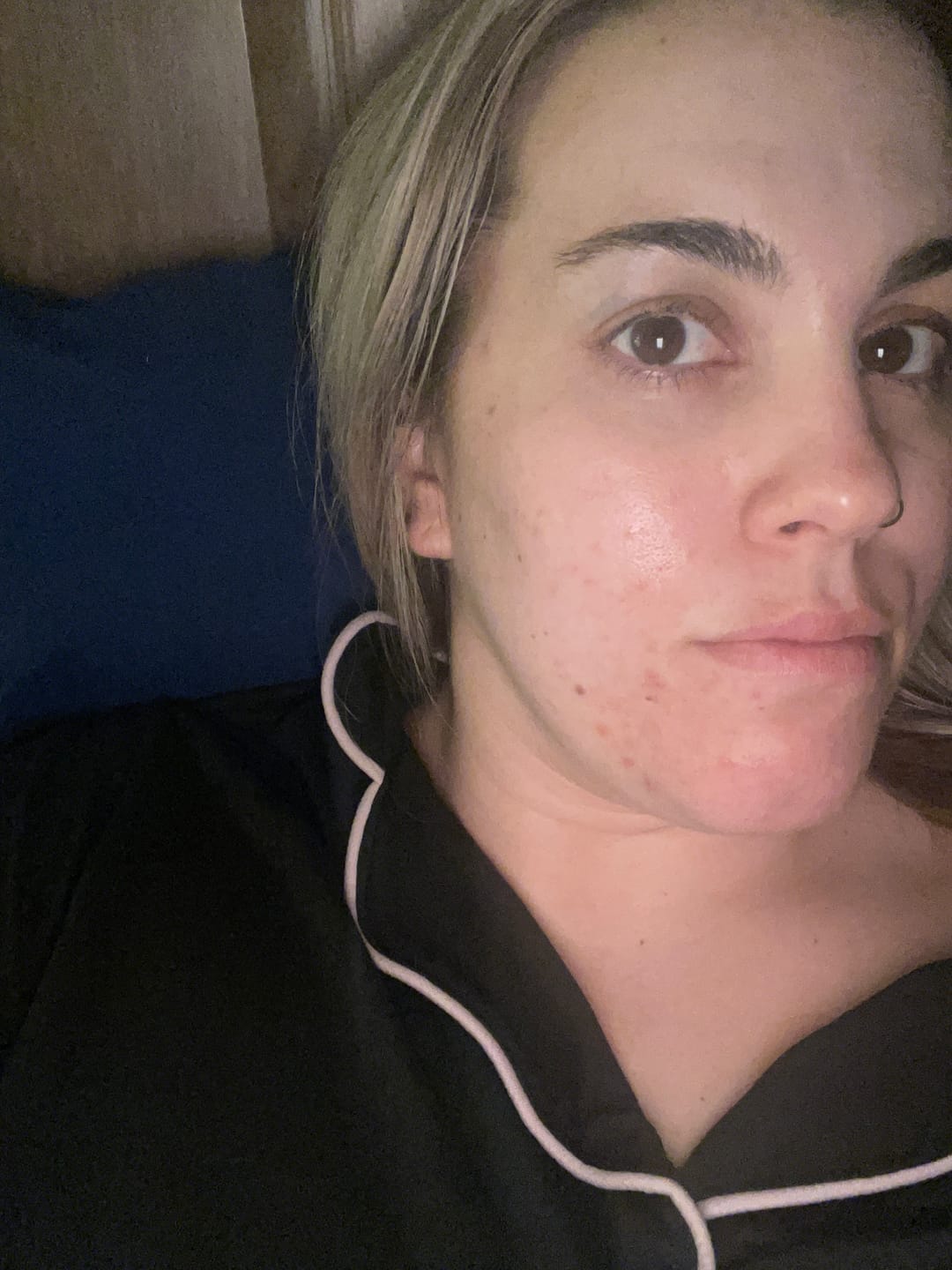 Customer photo review of Everywhere Tallow Balm