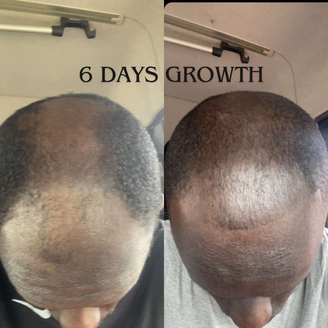 Customer photo review of Growth Boost Kit & Herbal Hair Growth Tea