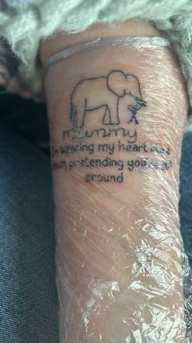 Customer photo review of TattooNumbx Numbing Cream