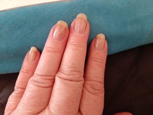 Customer photo review of Rocket Nail Fuel Duo