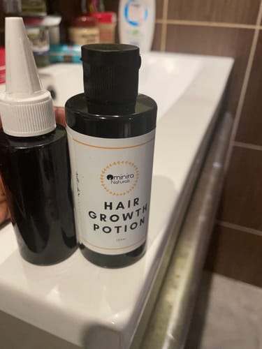 Customer photo review of Hair Growth Potion