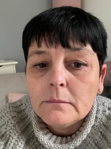 Customer photo review of QuickLash Starter Kit