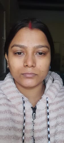 Customer photo review of Instant Facial Combo