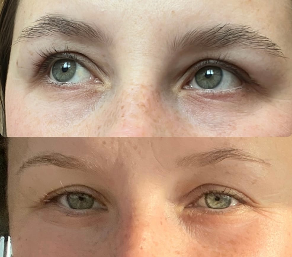 Customer photo review of IZABELL ROLLER - רולר לצמיחת הגבות מחדש