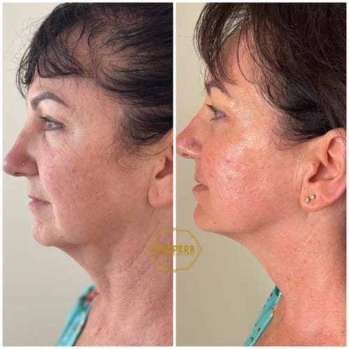 Customer photo review of SEA BUCKTHORN SERUM