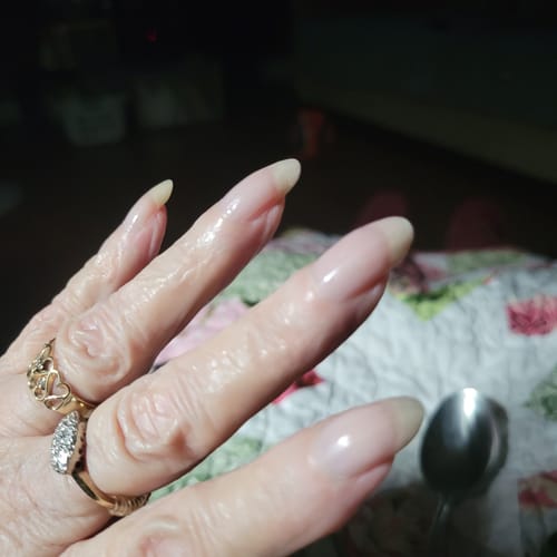 Customer photo review of Conceal & Repair Kit