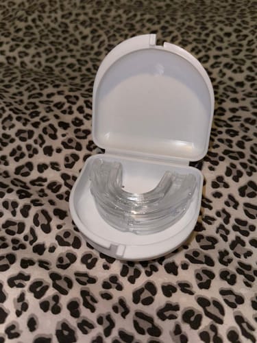 Fotorecensie van een klant over Anti Snurkbeugel
