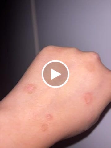 Customer video review of Prebiotic Hand Cream