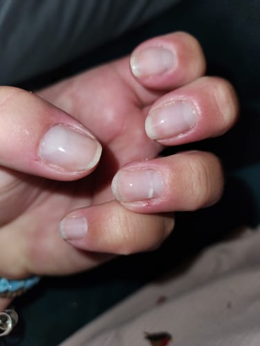 Customer photo review of Rocket Nail Fuel Nail Repair - Clear