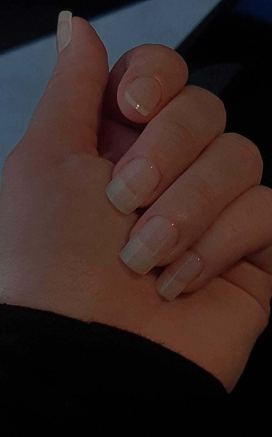 Customer photo review of Crystal Clear DIY Semicured Gel Nail Sticker Kit (STOP NAIL BITING & GROW BRITTLE NAILS)