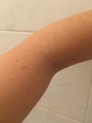 Customer photo review of Luelle Exfoliating Glove