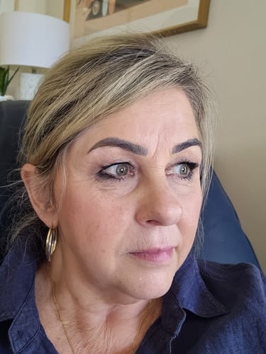 Customer photo review of SEA BUCKTHORN SERUM