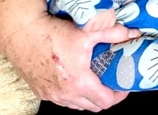 Customer photo review of Healing Miracle Cream