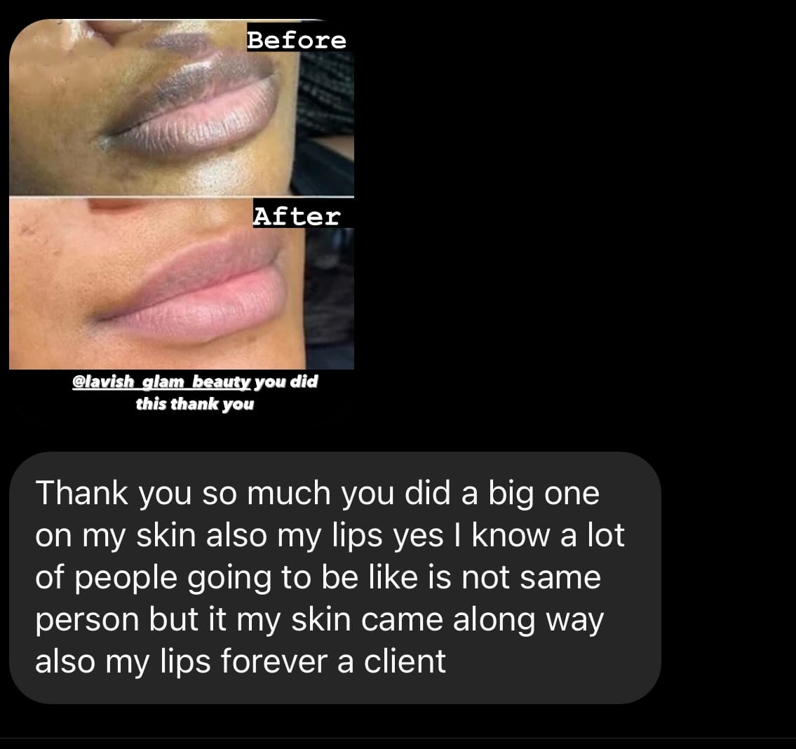 Customer photo review of Pink Lip Kit