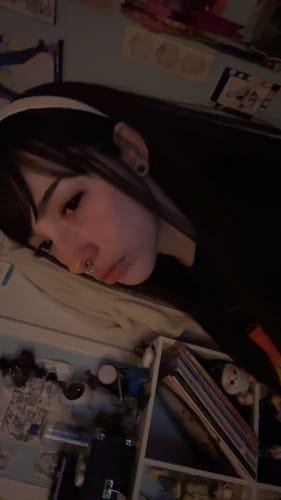 Customer photo review of Linn's Sullen Doll Eye 17mm Mini Sclera Contact Lenses(12 months of use)