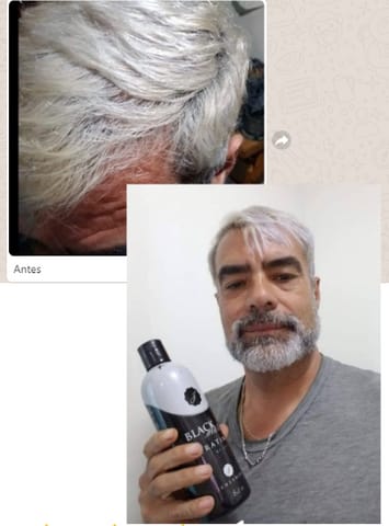 Customer photo review of Duo Platinum - Platina el cabello al instante.