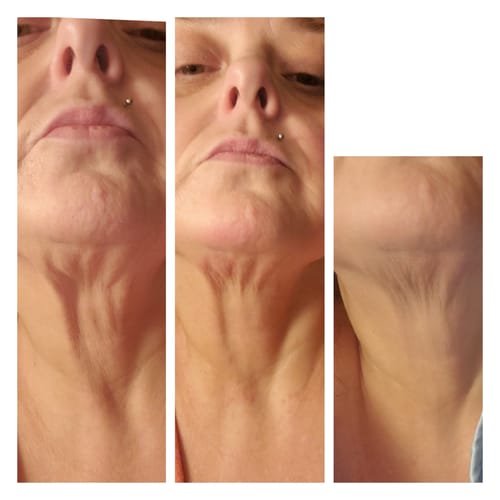 Customer photo review of Nia - Micro-Glow