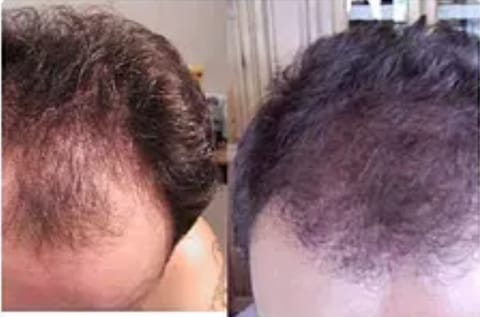 Customer photo review of Trio Bio - Sano