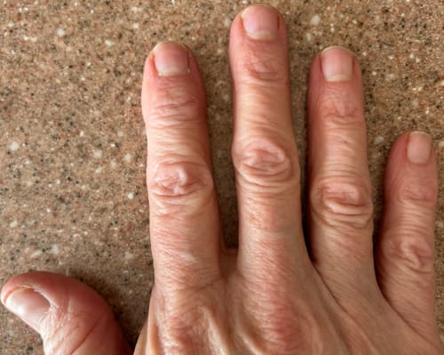 Customer photo review of Nail Care Pro