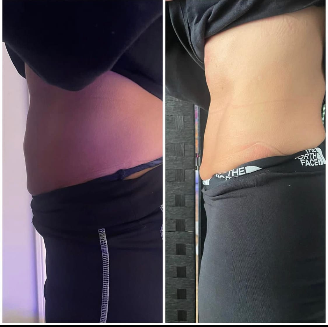Customer photo review of EMSlim Neo Machine Portable Pro