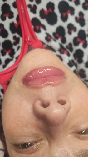 Customer photo review of Scalpa HyaInfuse
