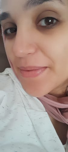 Customer photo review of Gamme Complète : Crème + Gel + Sérum