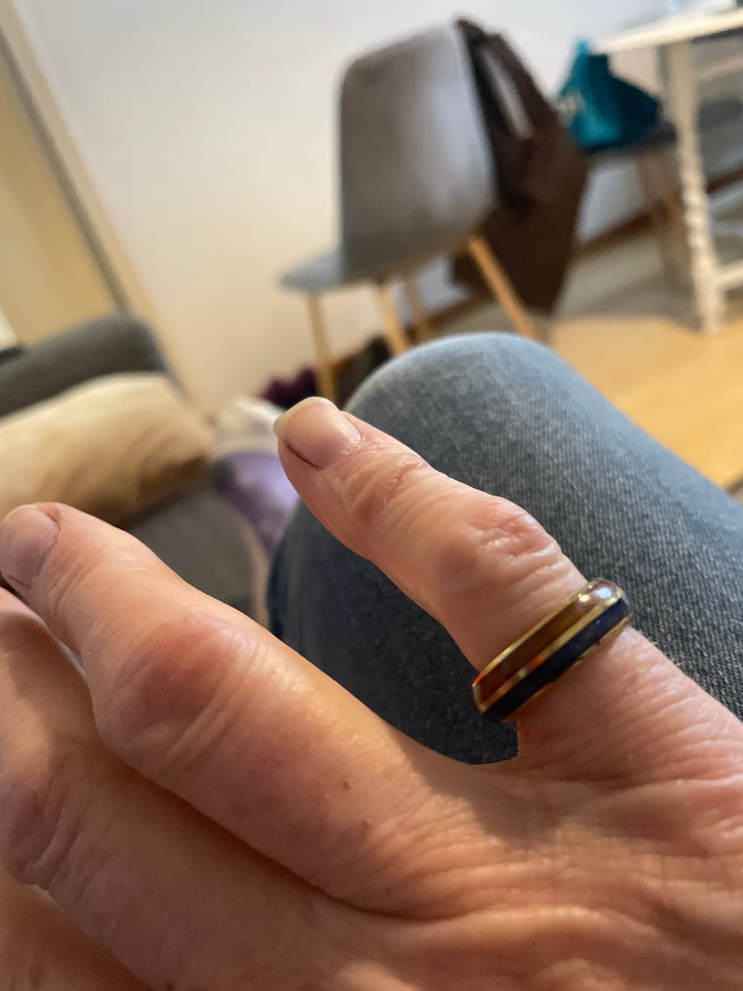 Customer photo review of The Golden Blue 6mm Wonder Ring