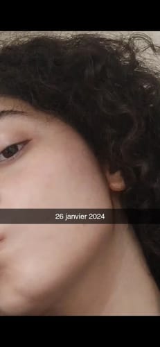 Customer photo review of Pack Anti-Imperfections