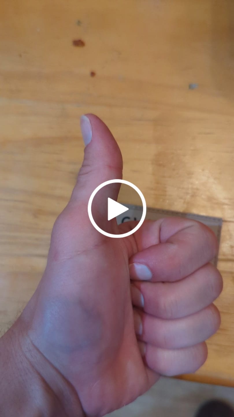 Customer video review of Shoot Me Patch