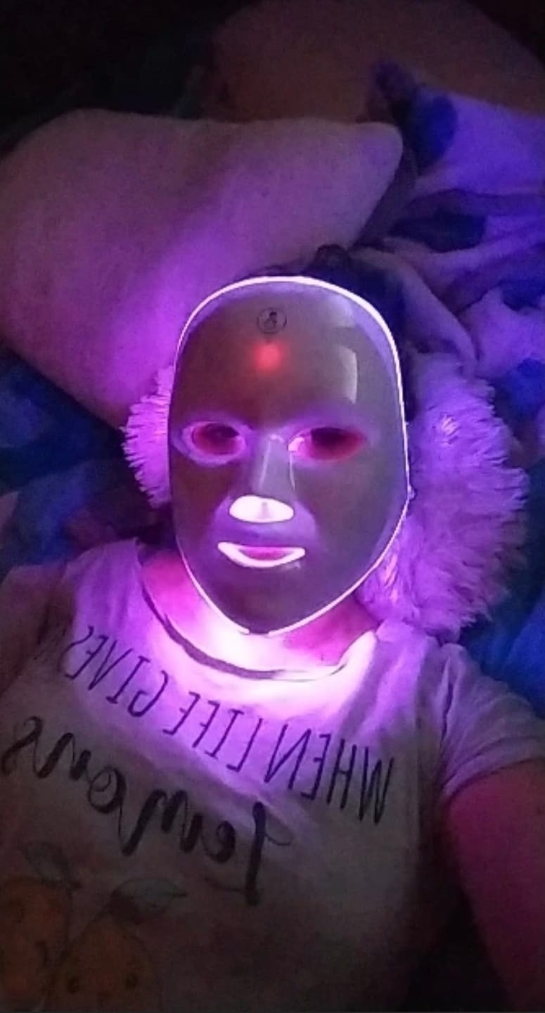 Customer photo review of The Naked Skin Mask™