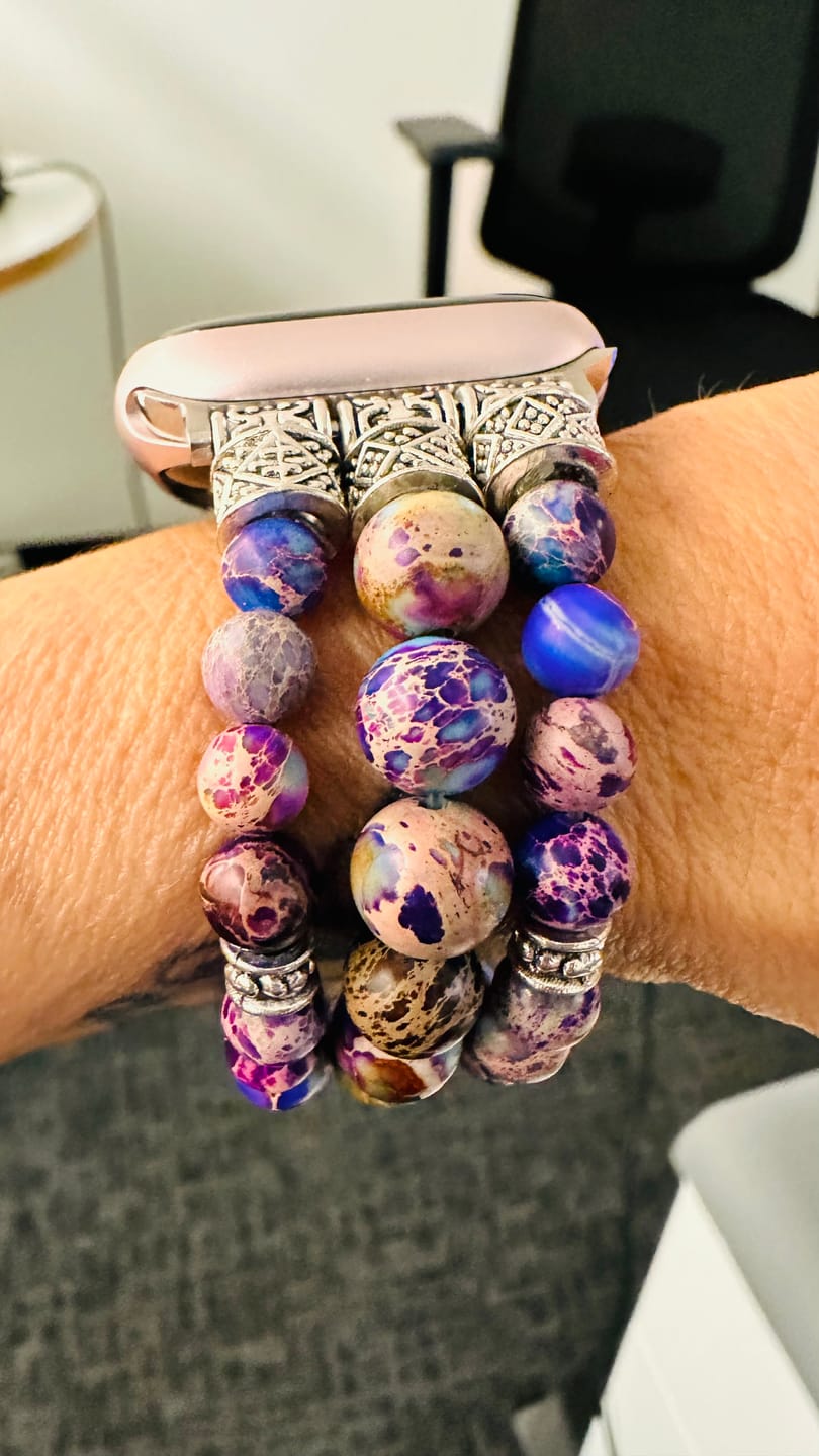 Customer photo review of Intense Jasper Stretch Apple Watch Strap
