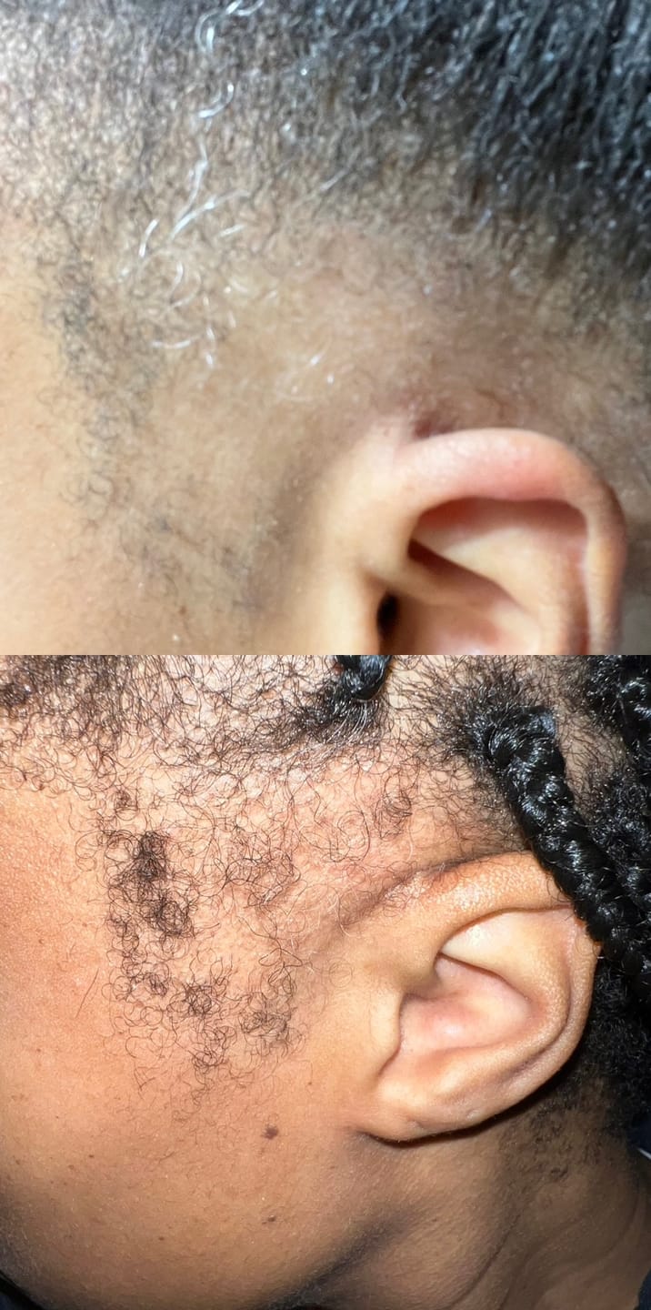Customer photo review of Hair Growth Potion - Extra Strength