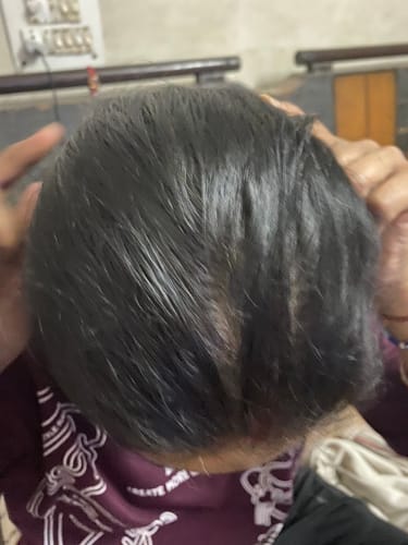 Customer photo review of Champi Hair Massage Oil  For Scalp & Hair Growth - Rituals - Hair Oil