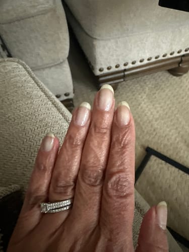 Customer photo review of Rocket Nail Fuel Nail Repair - Clear
