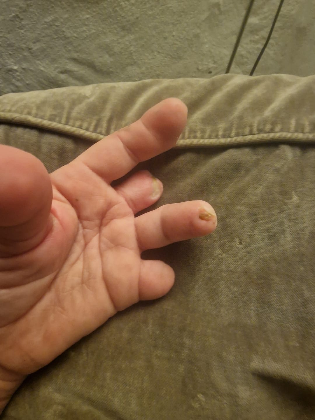 Customer photo review of NMN Pulver: 100 gram