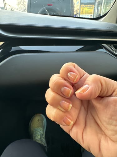 Customer photo review of The Nail Starter Kit