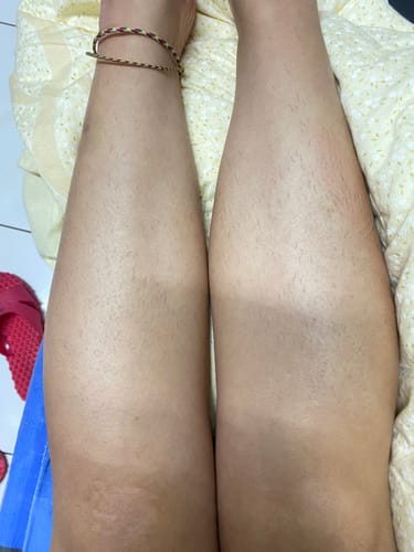 Customer photo review of 藍寶石 Air+ 冰墨綠 家用除毛儀