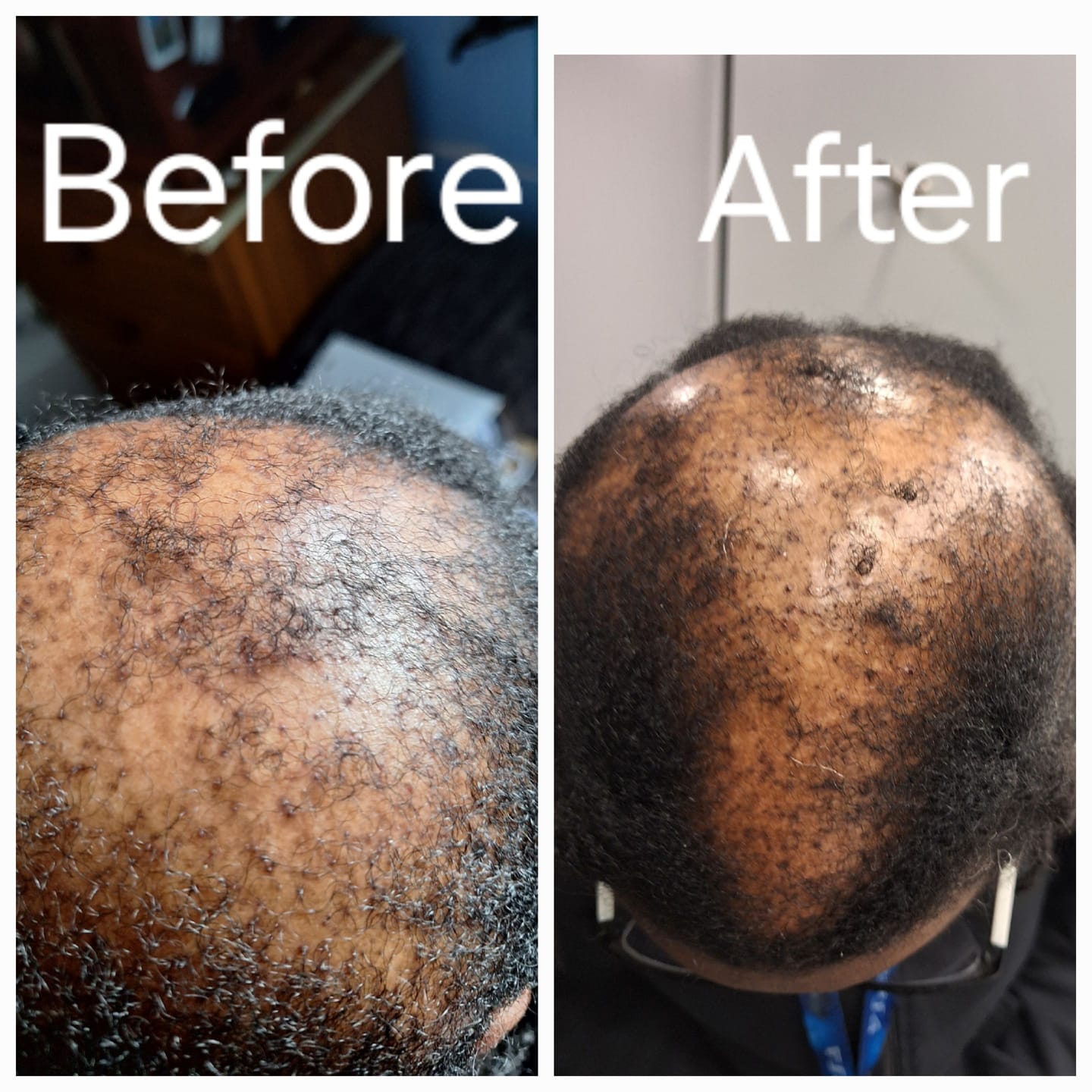Customer photo review of "Tangle Slayer" Extreme Slip Detangling Conditioner