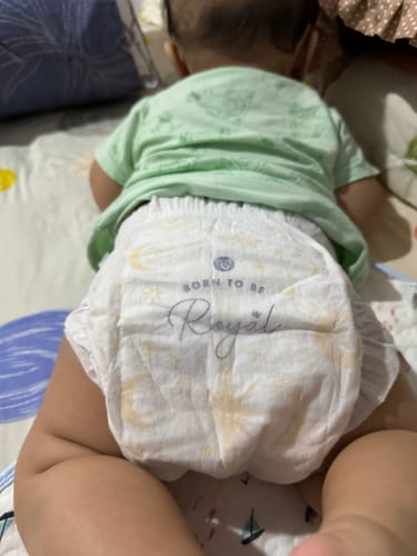 Customer photo review of [Trial Pack] RoyalDream Diapers 100% 7 Chemicals-Free